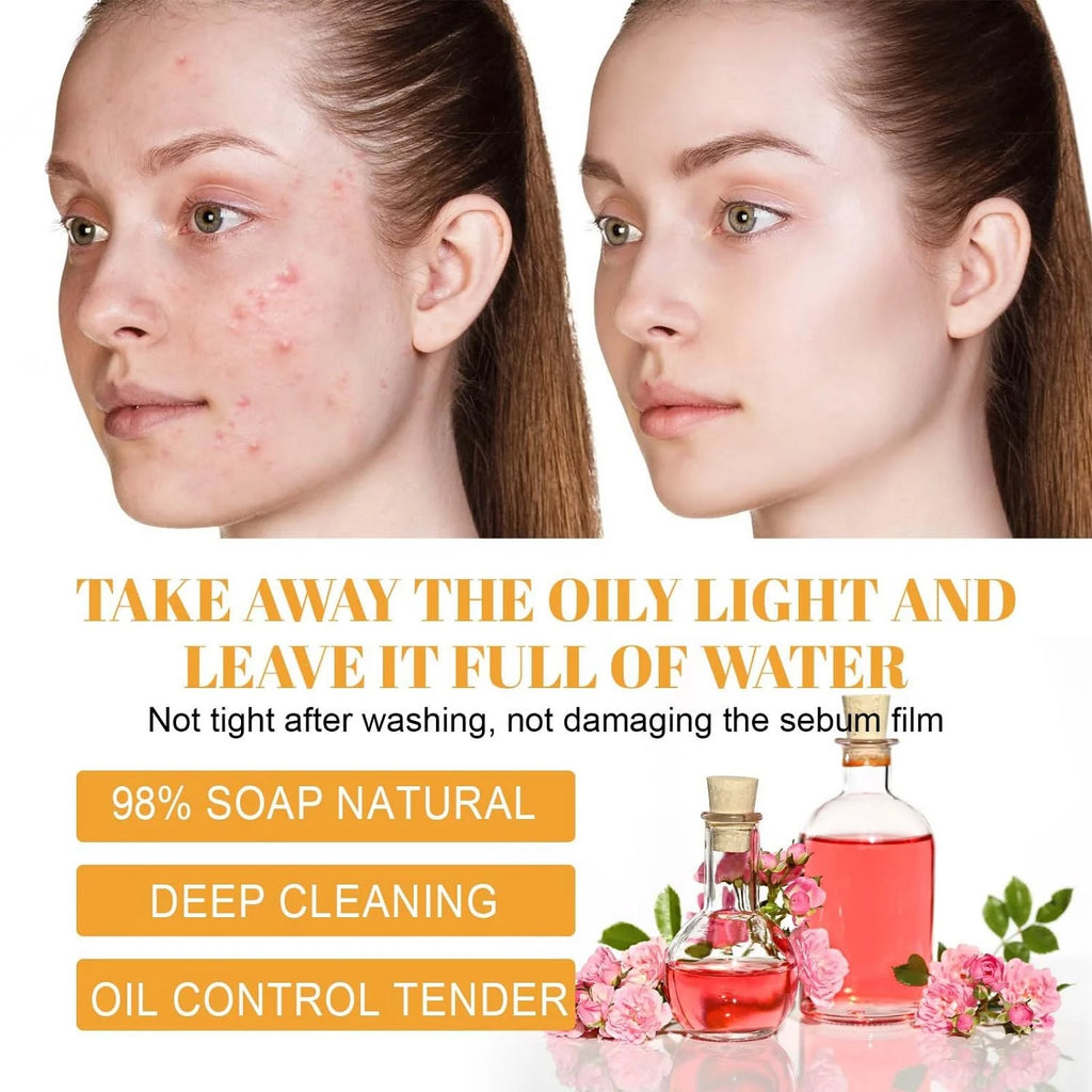 Turmeric Facial Cleanser with Soft Brush – Deep Foaming Face Wash for Brightening, Acne Control & Glowing Skin (100Ml)