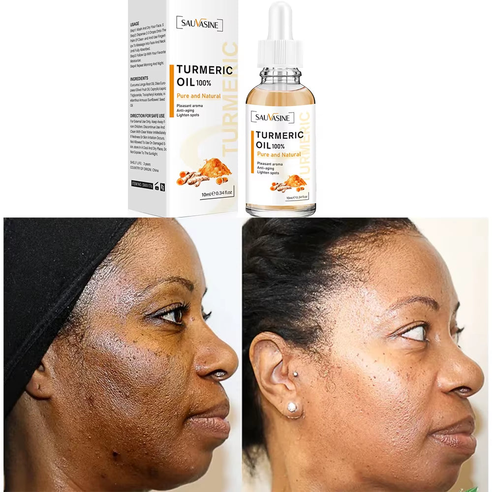 30Ml 100% Turmeric Oil anti Aging Face Whitening Serum Reduce Wrinkle Fine Lines Dark Spot Brightening Facial Lighten Men Women