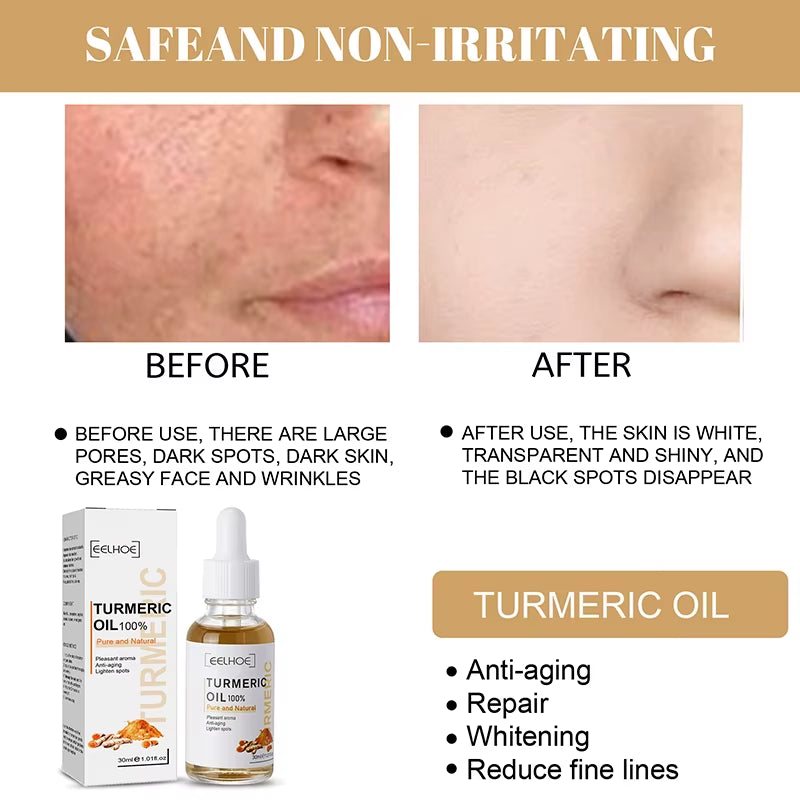 30Ml Turmeric Oil Skin to Lightening Acne Dark Patches Acne Bright Skin Dark Spot Corrector anti Aging Face Whitening Serum Care
