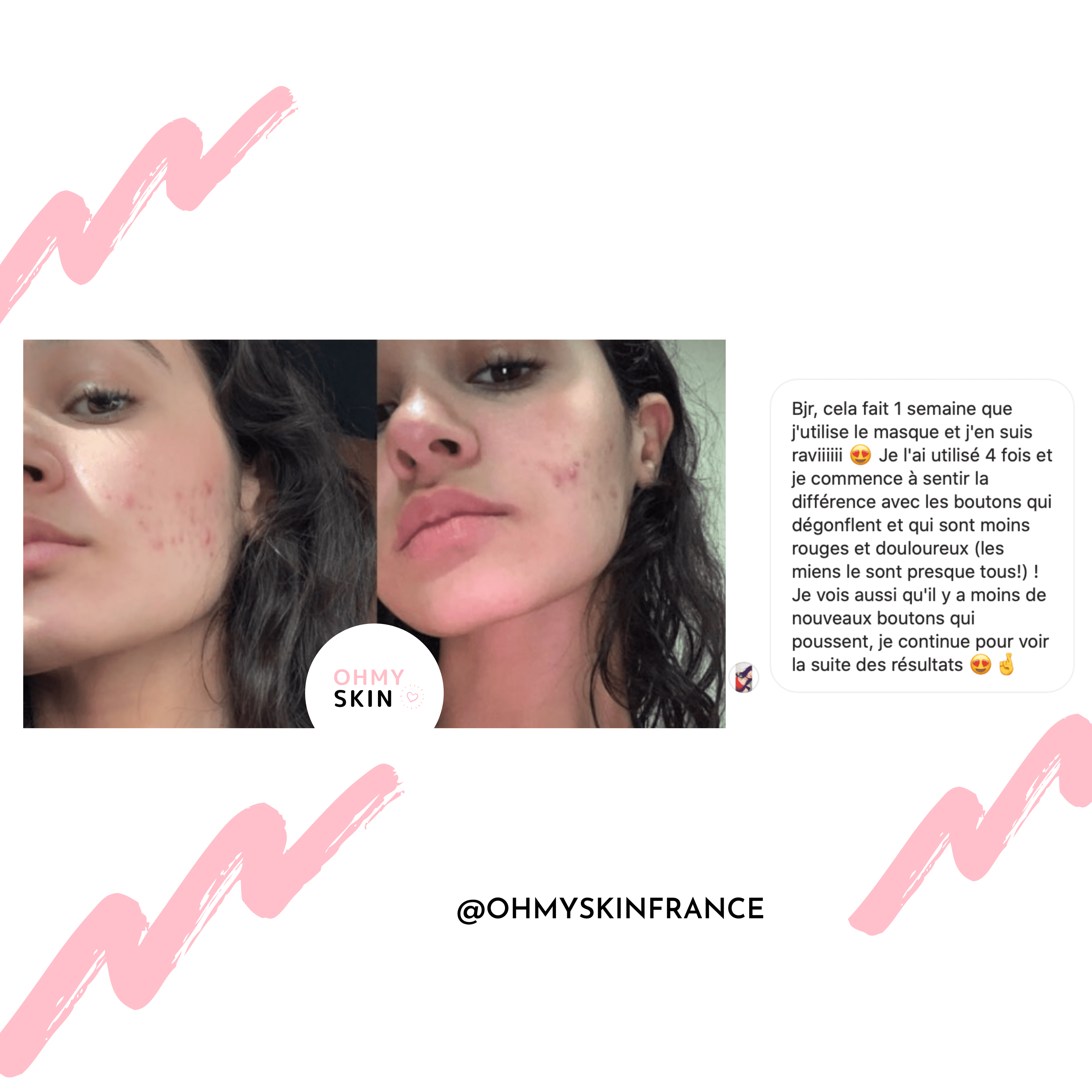 Masque De Luminothérapie Ohmyskin