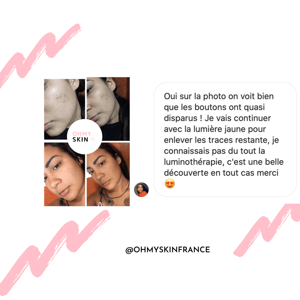 Masque De Luminothérapie Ohmyskin