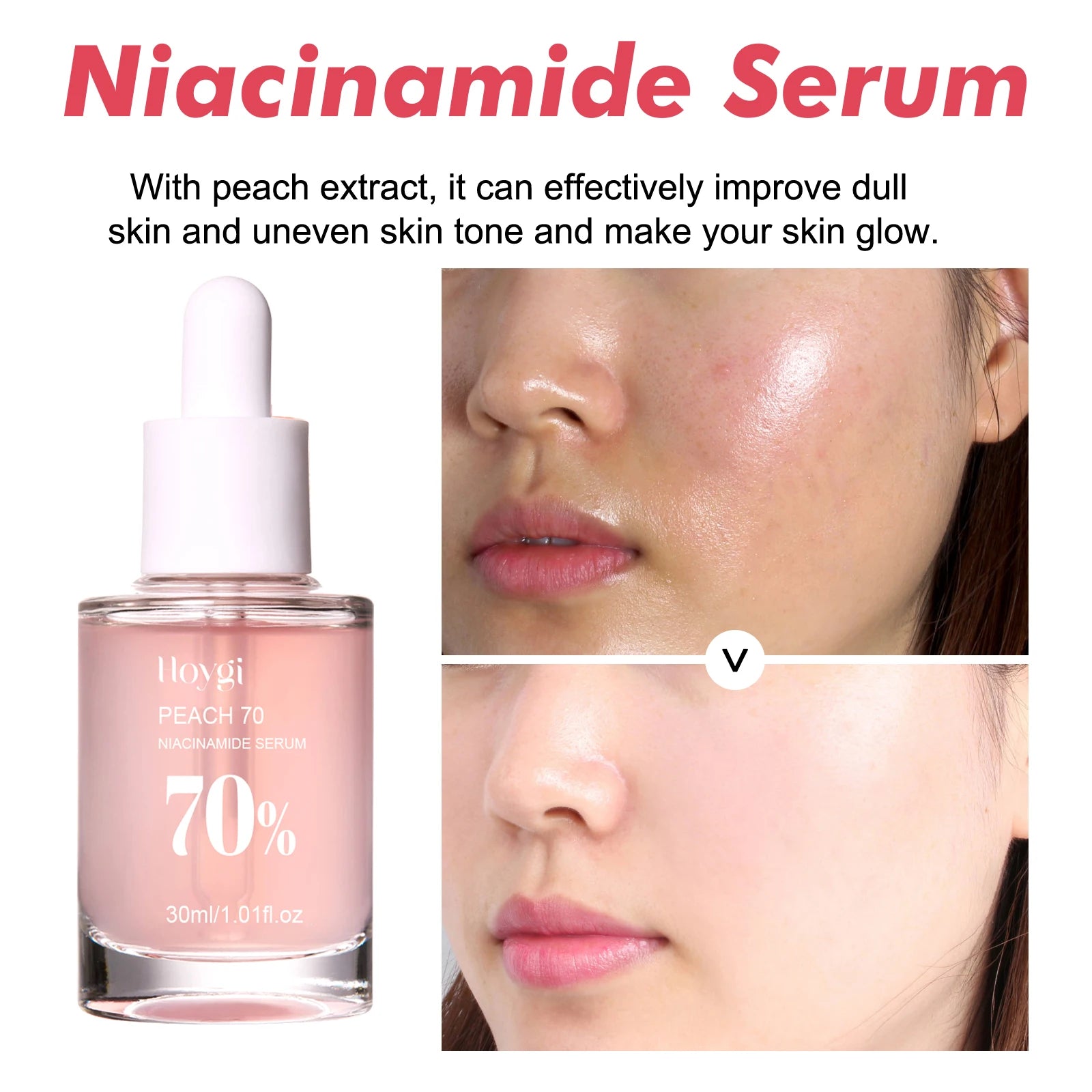 HOYGI pêche Niacinamide sérum pour le visage fondu mélanine tache foncée rétrécit les Pores lisse éclaircir la peau hydratant rajeunissement soins de la peau