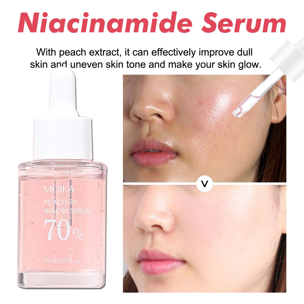 Sérum Niacinamide dissolvant de taches foncées, estompe les marques d'acné, Hyperpigmentation, rétrécit les Pores, même le teint, hydratant, soins pour la peau coréens 3