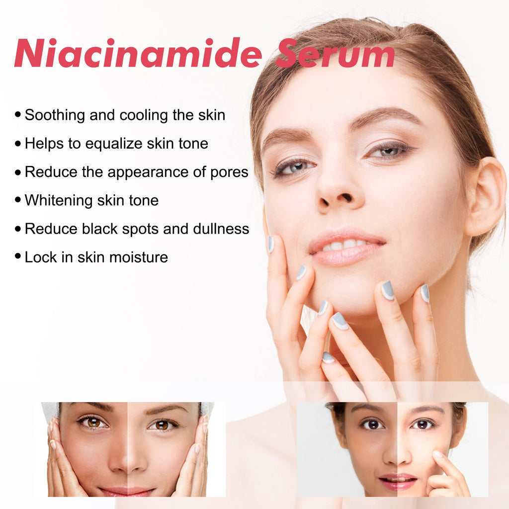 HOYGI pêche Niacinamide sérum pour le visage fondu mélanine tache foncée rétrécit les Pores lisse éclaircir la peau hydratant rajeunissement soins de la peau