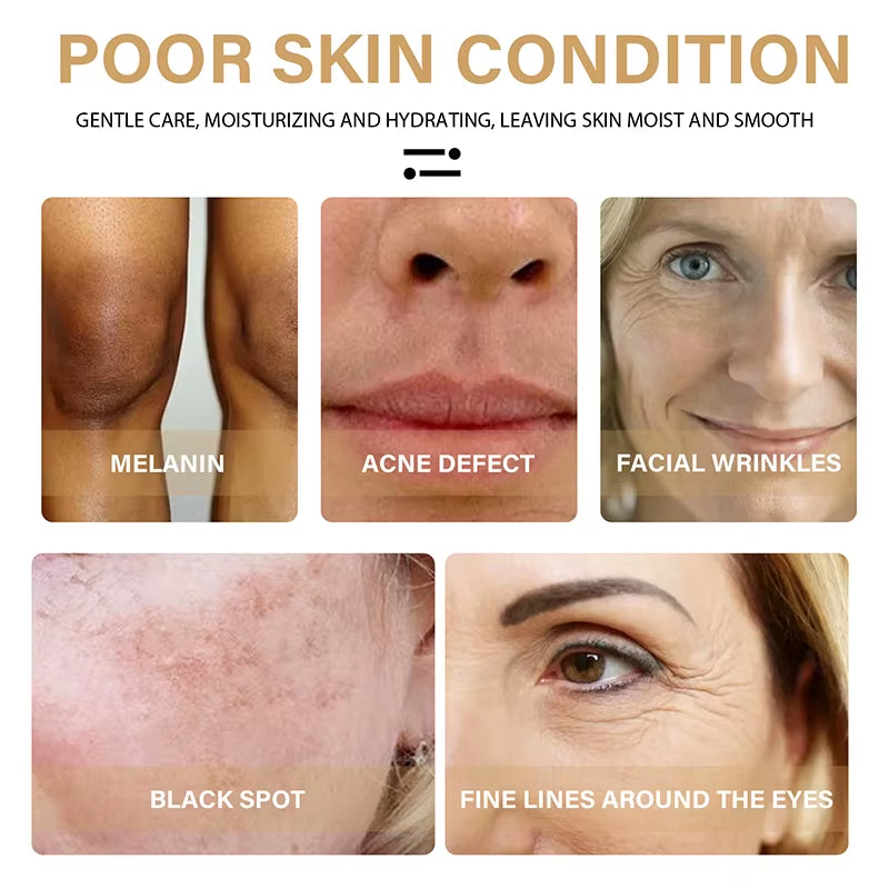 30Ml Turmeric Oil Skin to Lightening Acne Dark Patches Acne Bright Skin Dark Spot Corrector anti Aging Face Whitening Serum Care