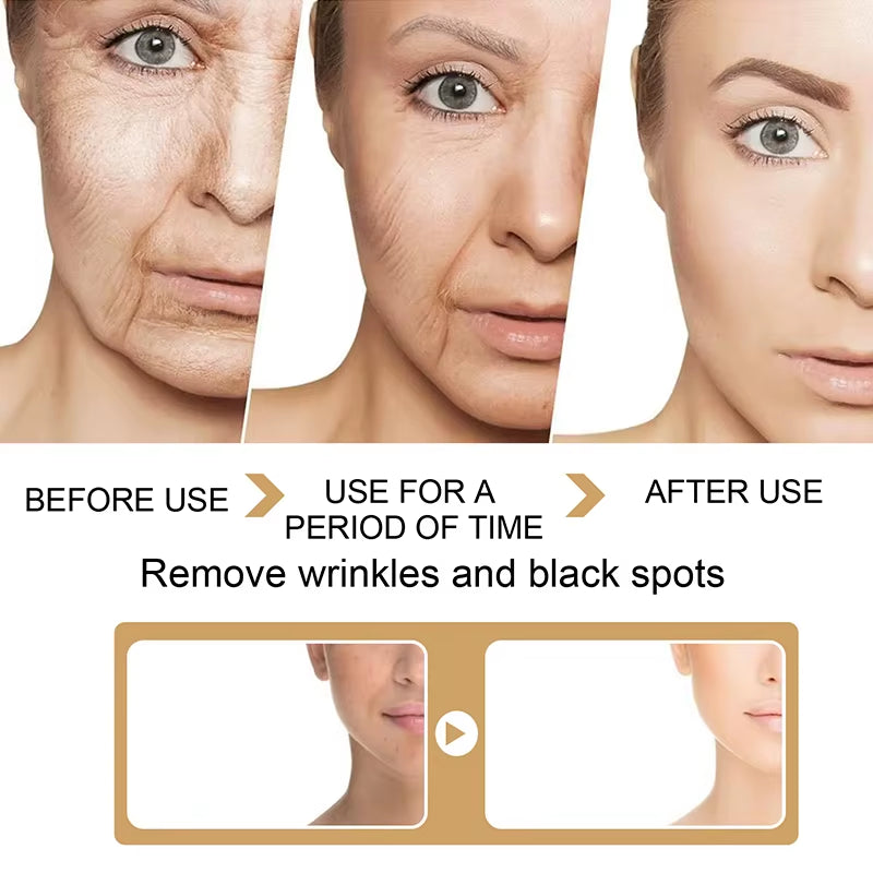 30Ml Turmeric Oil Skin to Lightening Acne Dark Patches Acne Bright Skin Dark Spot Corrector anti Aging Face Whitening Serum Care