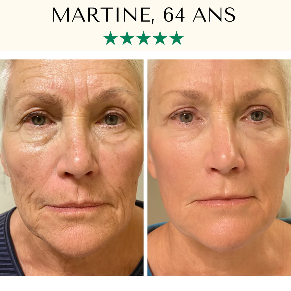 Masque LED Anti-Âge Pro - Visage