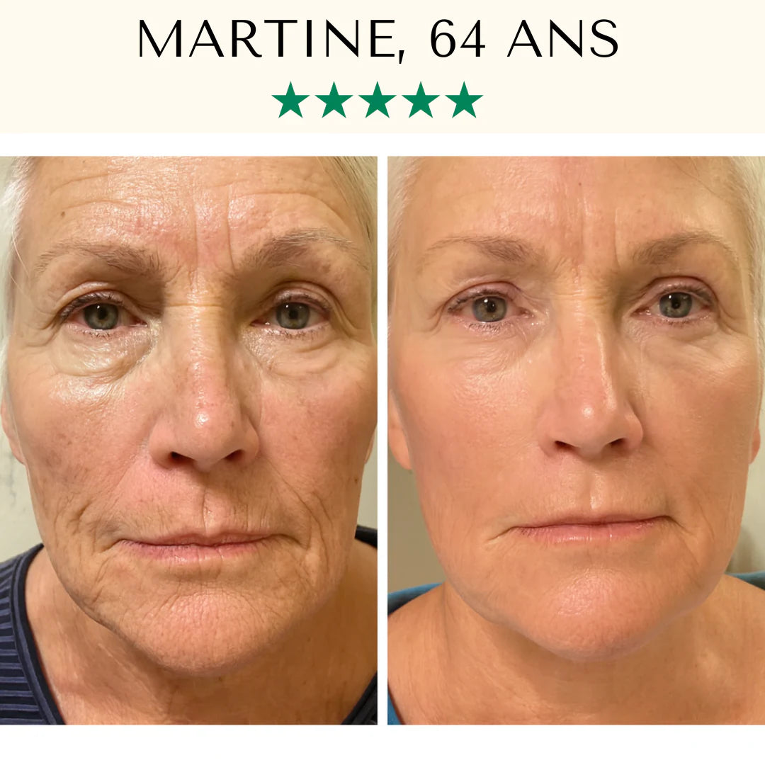 Masque LED Anti-Âge Pro - Visage