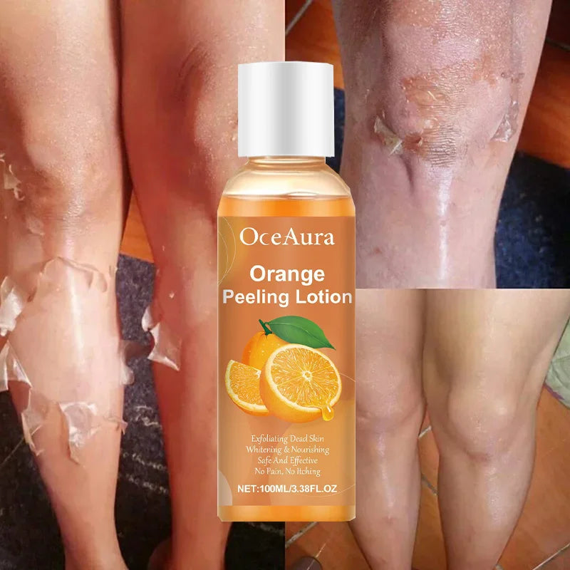 Orange Peeling Body Lotion Gentle Exfoliation Gel Lotion Peeling Oil Tearable Ramen Wax Orange Peeling Lotion Wholesale