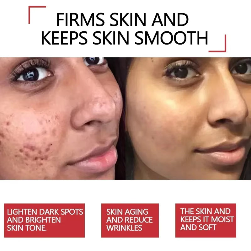 30Ml 100% Turmeric Oil anti Aging Face Whitening Serum Reduce Wrinkle Fine Lines Dark Spot Brightening Facial Lighten Men Women