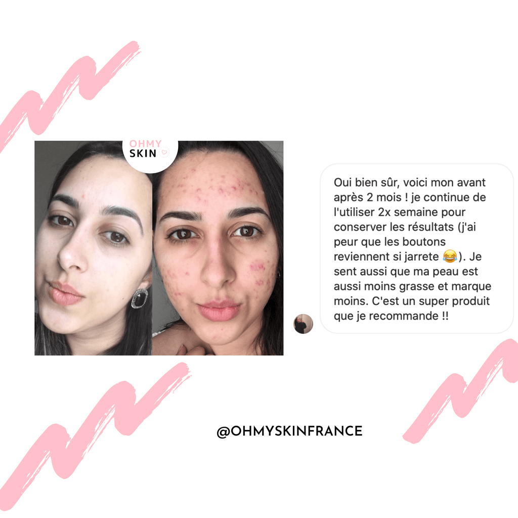 Masque De Luminothérapie Ohmyskin