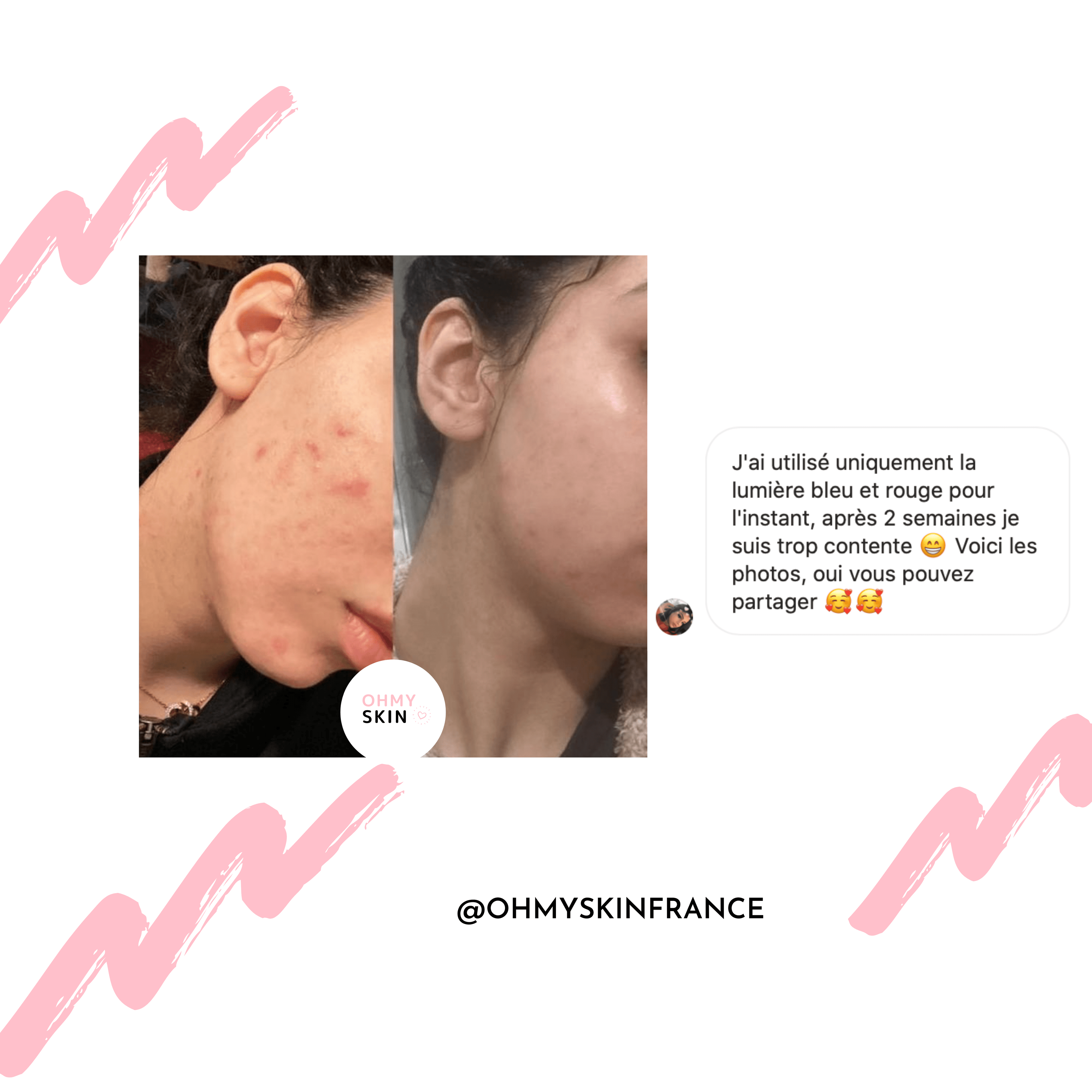 Masque De Luminothérapie Ohmyskin